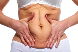 ABDOMINOPLASTIE-accueil